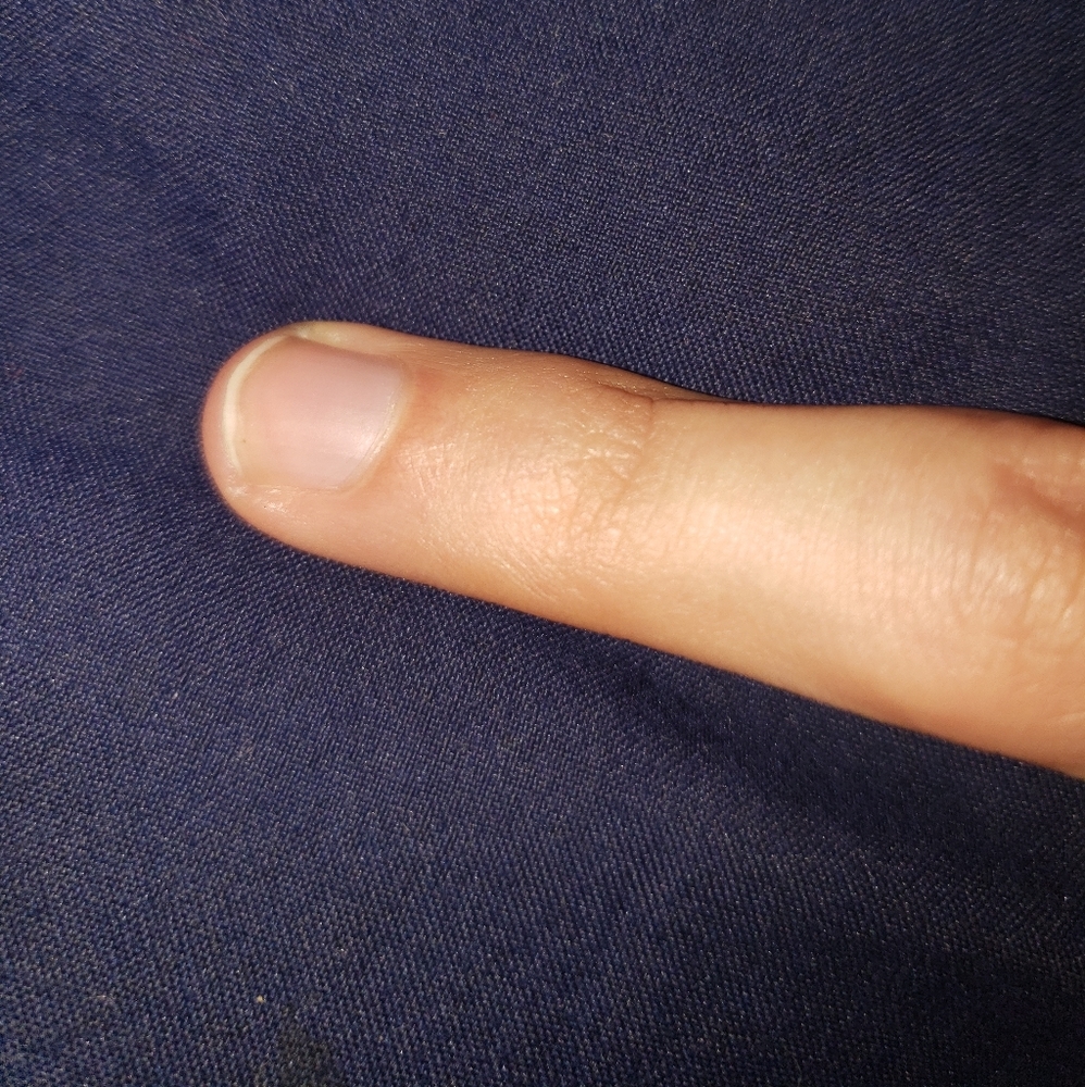 My Right Hand Pinky